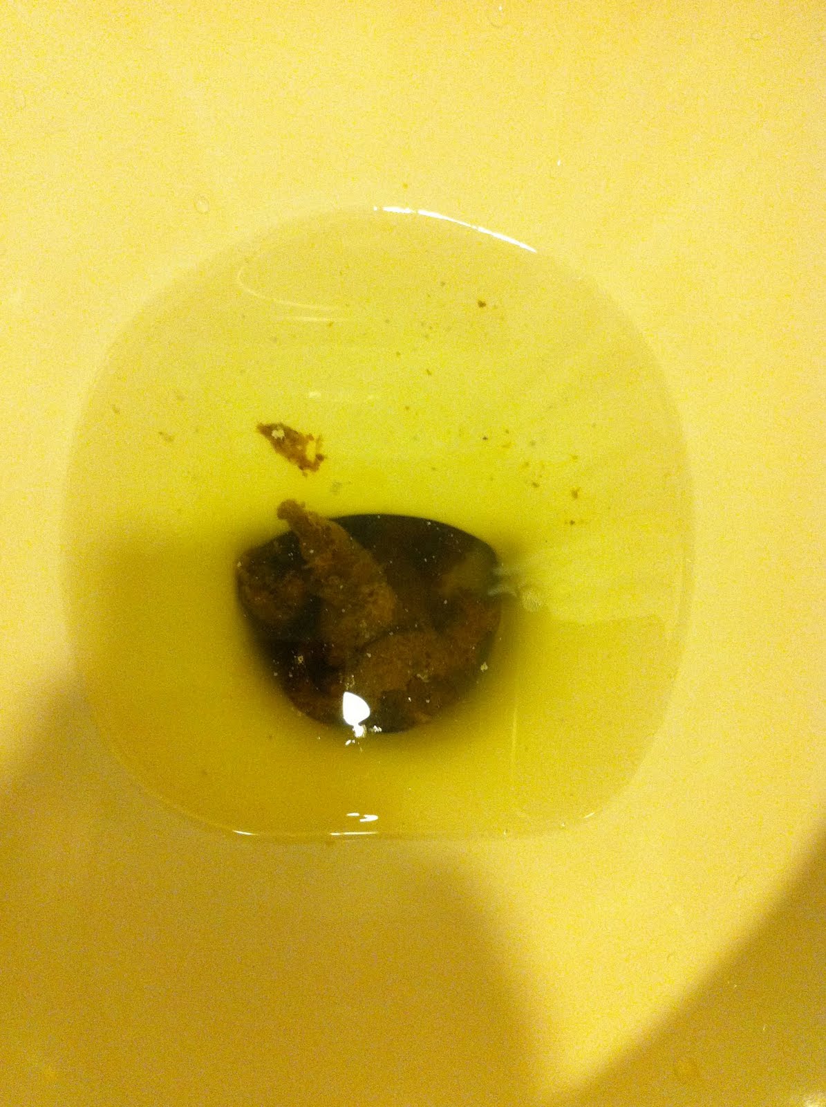 FileHuman Feces Bristol Stool Chart Type Wikimedia Commons, 43 OFF