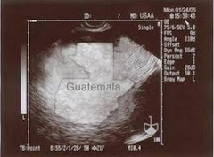 Guatemala Adoption Sonogram