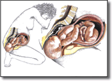 [birth+2.gif]