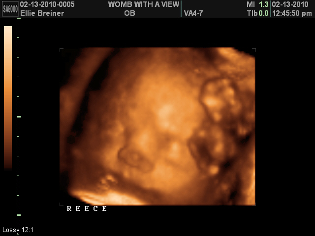 Life, Love, and Baby.: 27 weeks: 3d/4d ultrasound