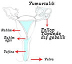 [disgebelikyeri_3.jpg]