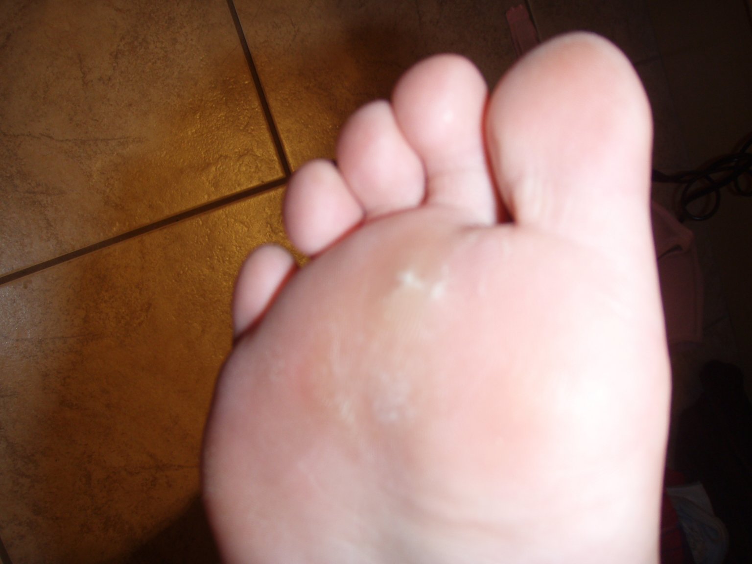 Tha Beauty Blogger Compound W Wart Remover Pads