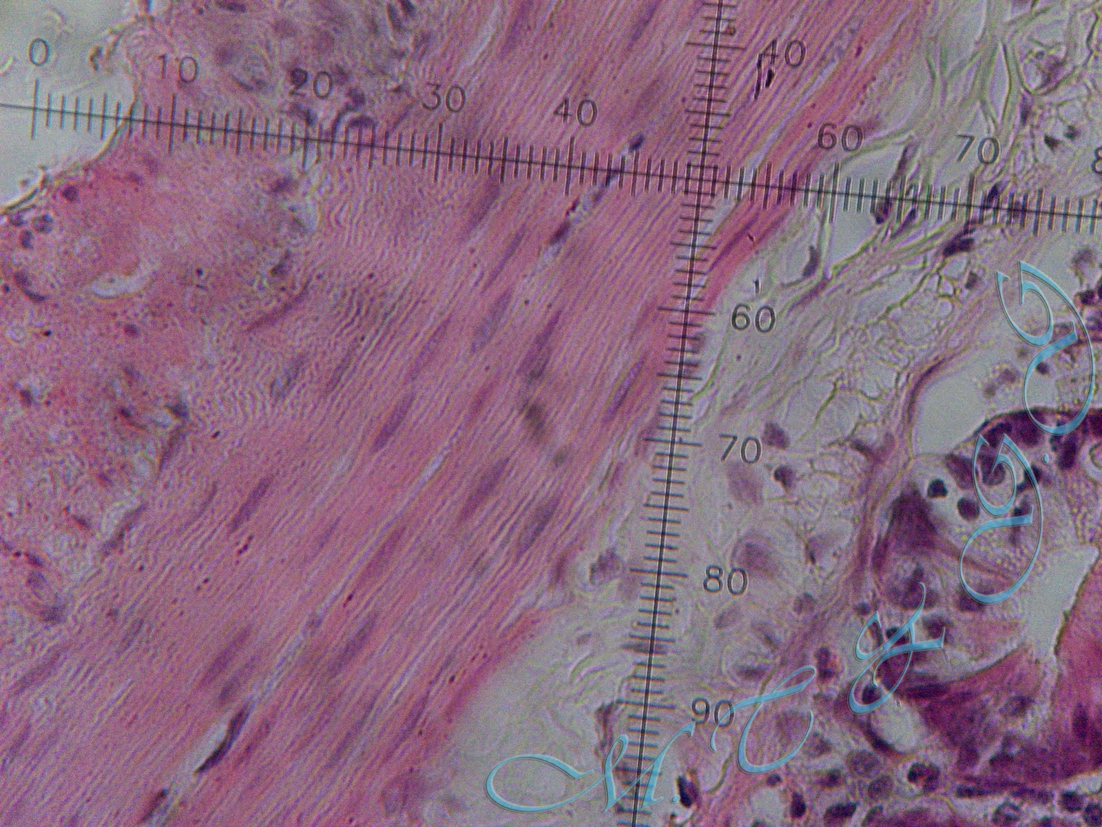 ANADOLU BİYOLOJİ Histoloji Lab. Fotoğrafları / Kas Doku / Düz Kas Dokusu ANADOLU BİYOLOJİ Histoloji Lab. Fotoğrafları / Kas Doku / Düz Kas Dokusu