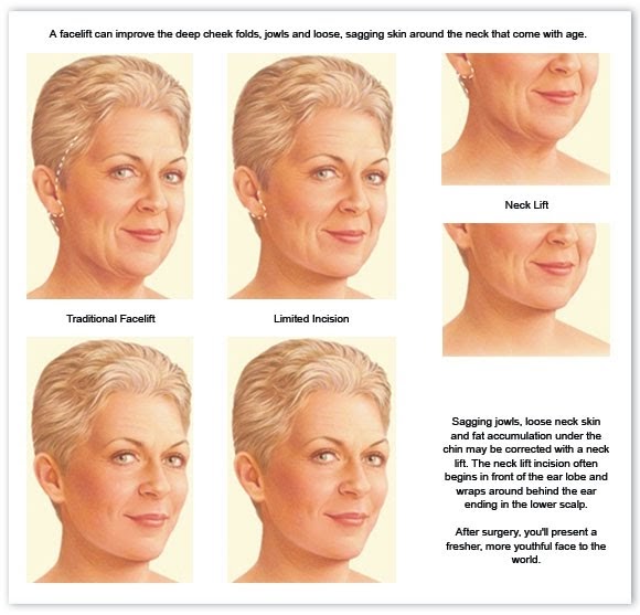 Упражнения от 2 подбородка. Deep cheeks. Access facelift схема. Lefileo филлер. Deep cheeks.