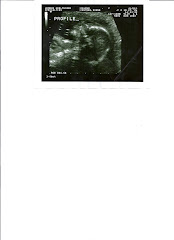 Ultrasound Oct 27thb