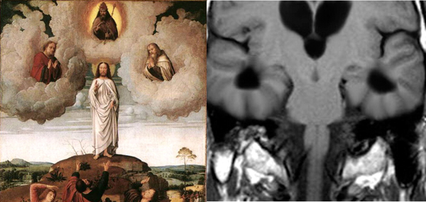 [David's+transfiguration+of+Christ.jpeg]