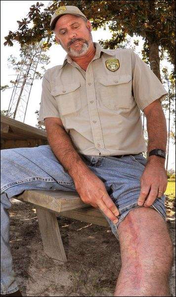 [rattlesnake+bitten+man.jpg]