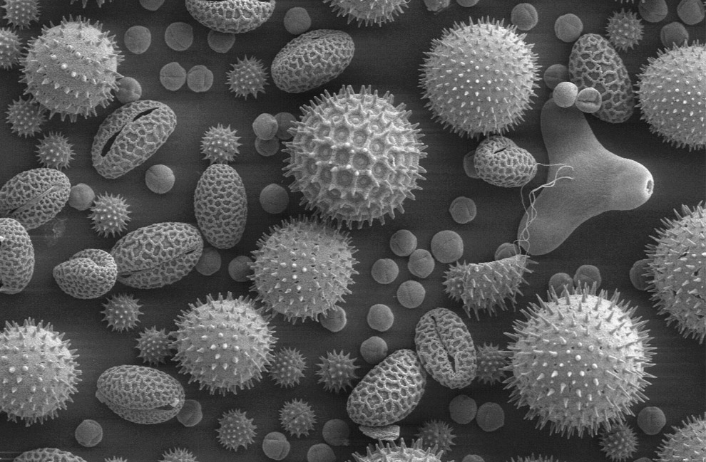 [SEM+pollen+grains.jpg]