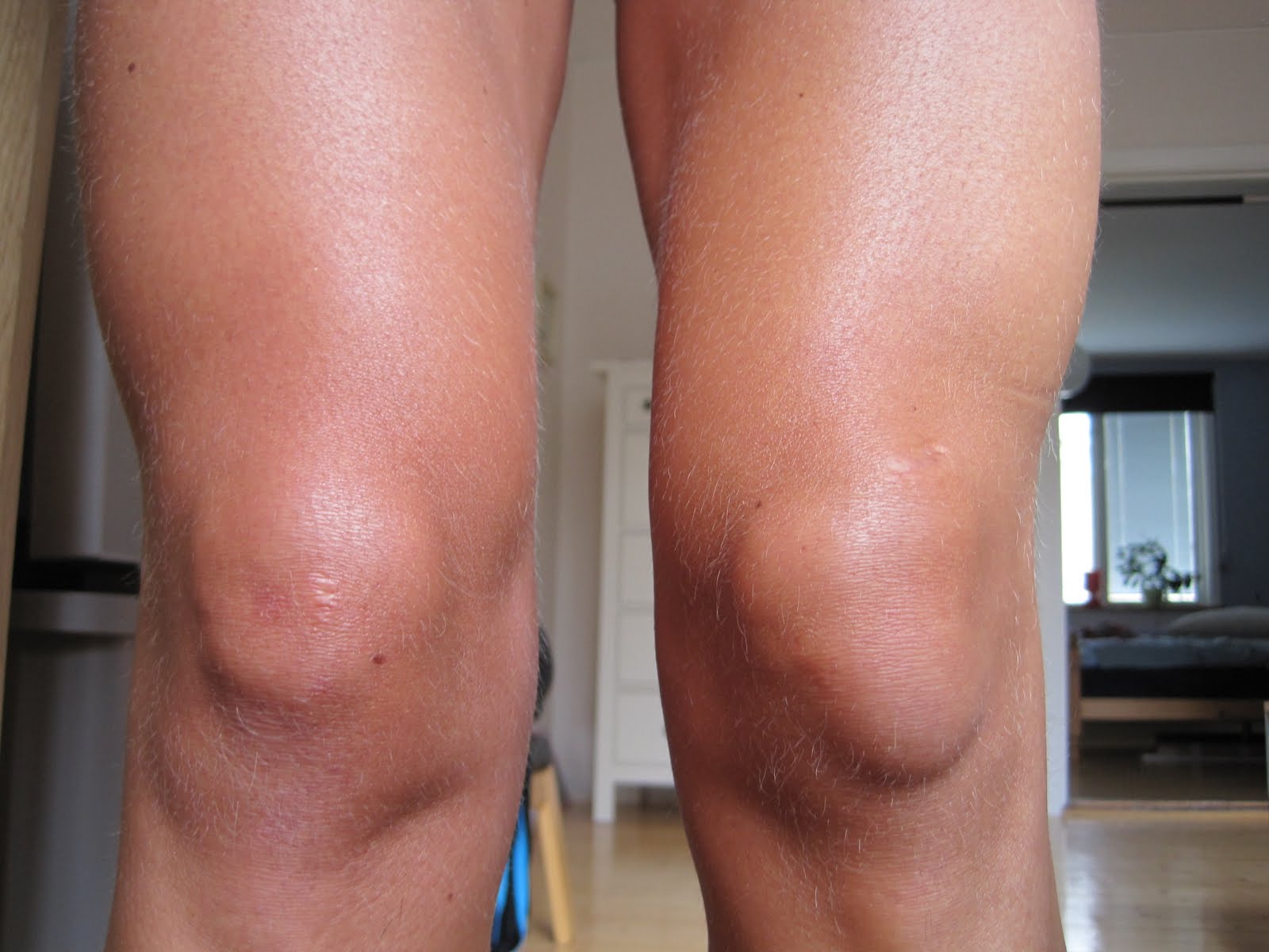 SpringaMera: Varning för känsliga......