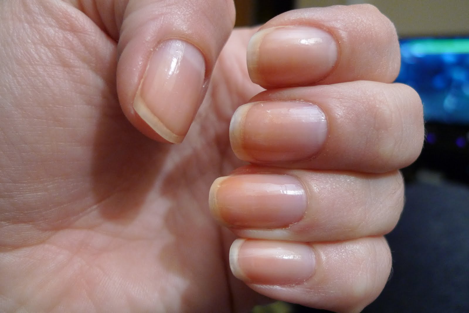 kittys claws Yellow stained nails