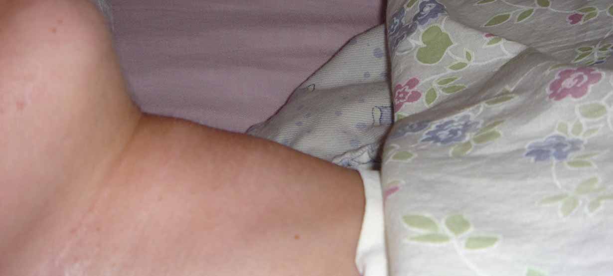 [CirurgiaPescoçoFa.jpg]