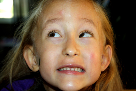 [2009.07.10HEyesBefore1.jpg]