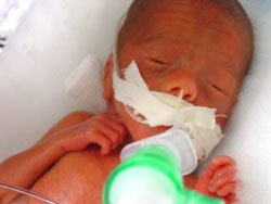 [2004.08.11EdenOpensEyes.jpg]