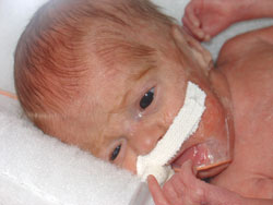 [2004.09.11EdenAwareFinger.jpg]