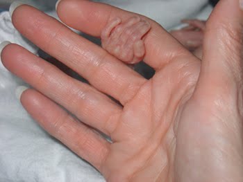 [2004.08.26Eden&NanaHands.jpg]