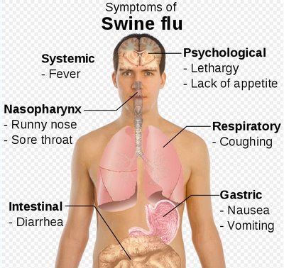 [symptoms+of+swine+flu.jpg]