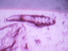 DEMODEX