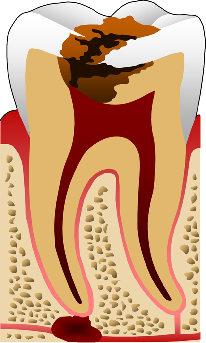KTI (karya tulis ilmiah): Pentingnya Kesehatan Gigi dan Mulut