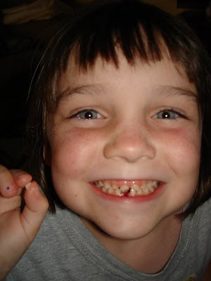 Scarlet #39 s quot A Thousand Words quot : KK Lost Her First Tooth 06 24 09