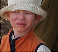 [albino.jpg]