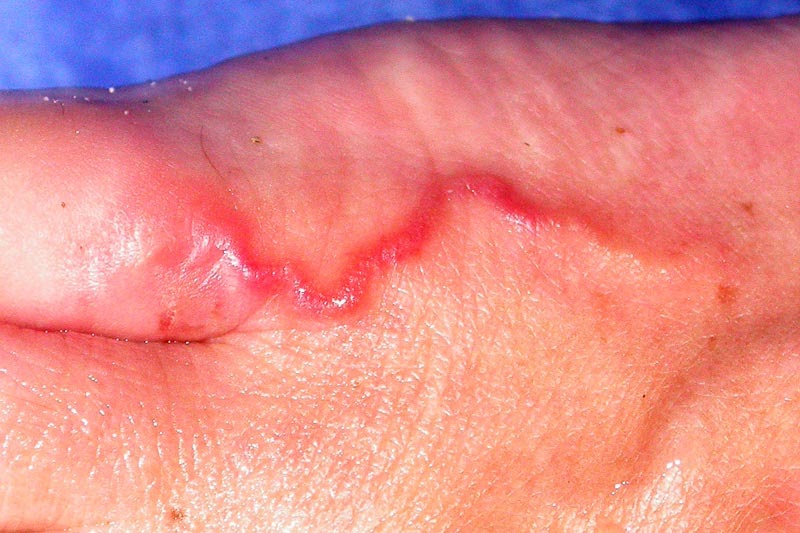 Histoires d'eau Le chien chie là Histoires d'eau Le chien chie là