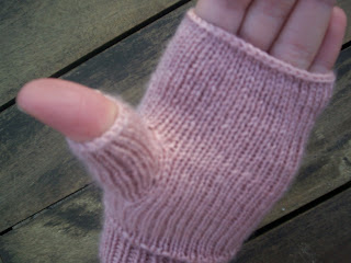 SpringerImages - Typical stocking-glove pattern of sensory