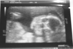 21 Weeks Jack looking straight at us