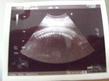 32 Week Scan