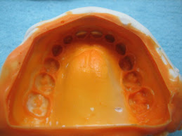 Impresion para realizar modelo en resina