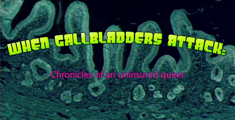 WHEN GALLBLADDERS ATTACK