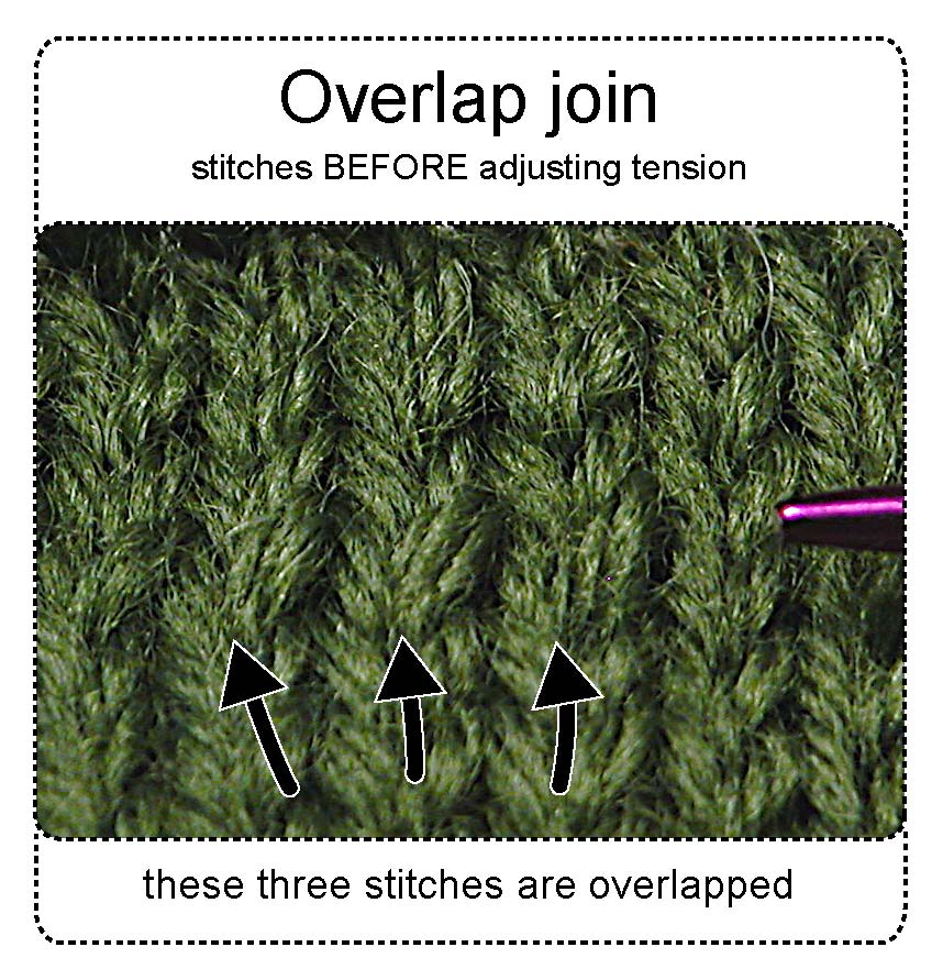 [stitches+unpulled.jpg]