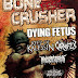 Dying Fetus - Keep of Kalessin - Carnifex - Annotations of an autopsy - Fleshgod Apocalypse - Angelus Apatrida - Bonecrusher Fest - Trabendo - Paris - 07/03/2011