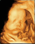 Our Baby Girl 31 wks