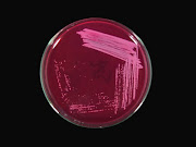 Staph. aureus in Mc conkey Agar