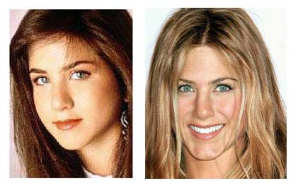 Cosmetic Surgery