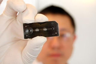 biosensor Biossensor ajudará a detectar Lúpus de forma rápida e barata