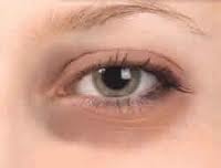 Banyak sekali orang yang mengalami masalah hitam pada mata atau lebih tepatnya pada kantun Cara Memutihkan Kantung Mata Hitam