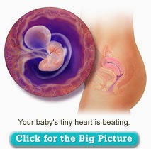 [overview6weeks.jpg]