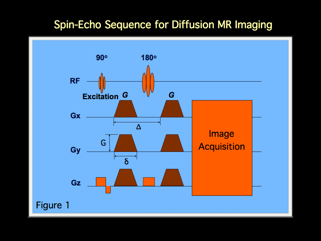 MRI BLOG Diffusion weighted MR Imaging mri-blog-diffusion-weighted-mr-imaging
