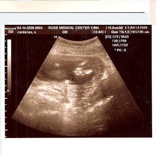 20 week 3d ultrasound face 20 week 3d ultrasound face