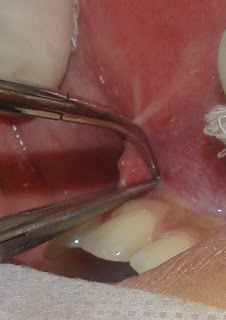 ONLINE ATLAS OF ORAL AND MAXILLOFACIAL SURGERY - ATLAS ONLINE DE ...
