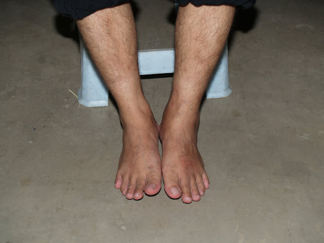 SELEPAS RAWATAN (GOUT)