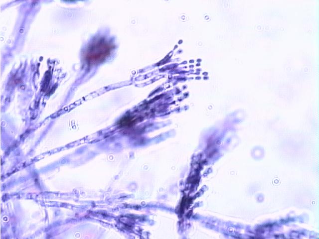 Нити мицелия споры. Пенициллин микроскопия. Мицелий пеницилла под микроскопом. Penicillium микроскоп. Грибок пенициллин под микроскопом.