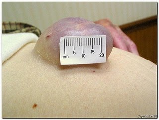 umbilical2_400.jpg