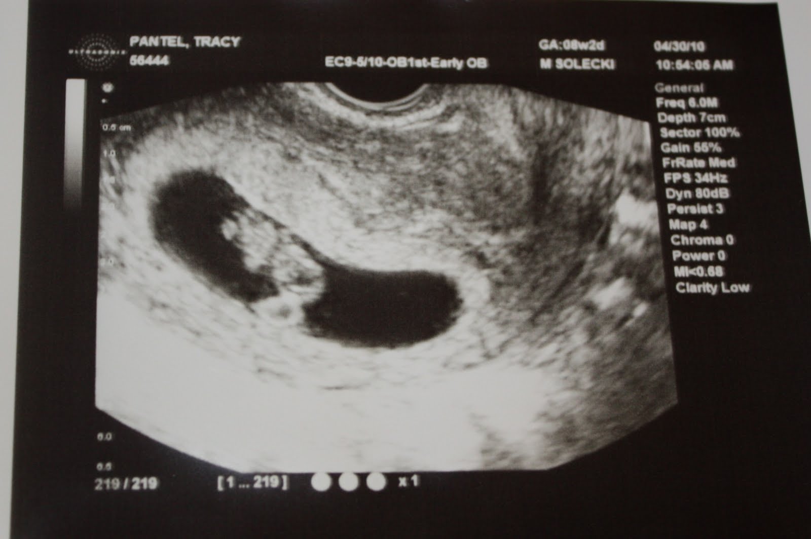 Pantel Family Blog 8 week ultrasound