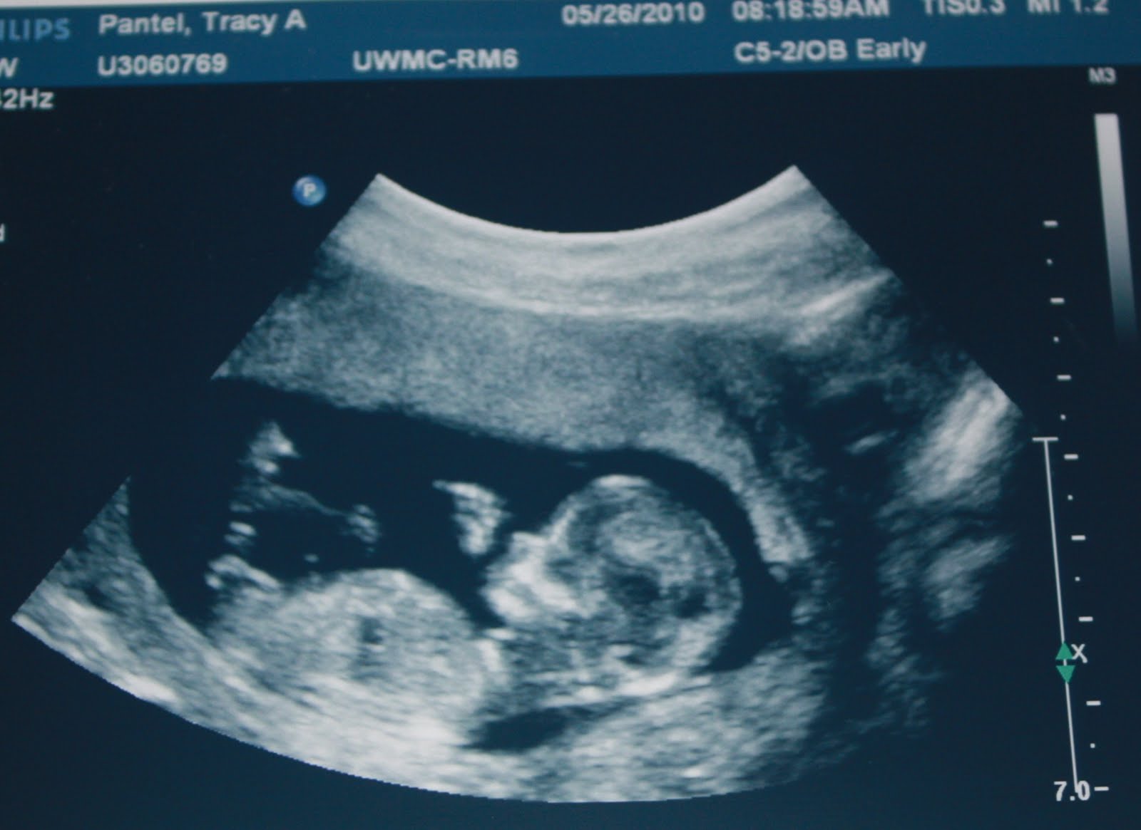 pantel-family-blog-12-week-ultrasound