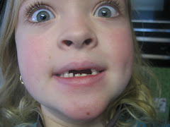 What happened to my teeth???