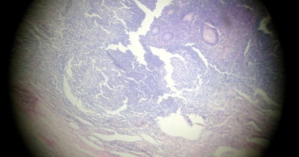 Histology Slides Database: Appendix histology slide (vermiform appendix ...