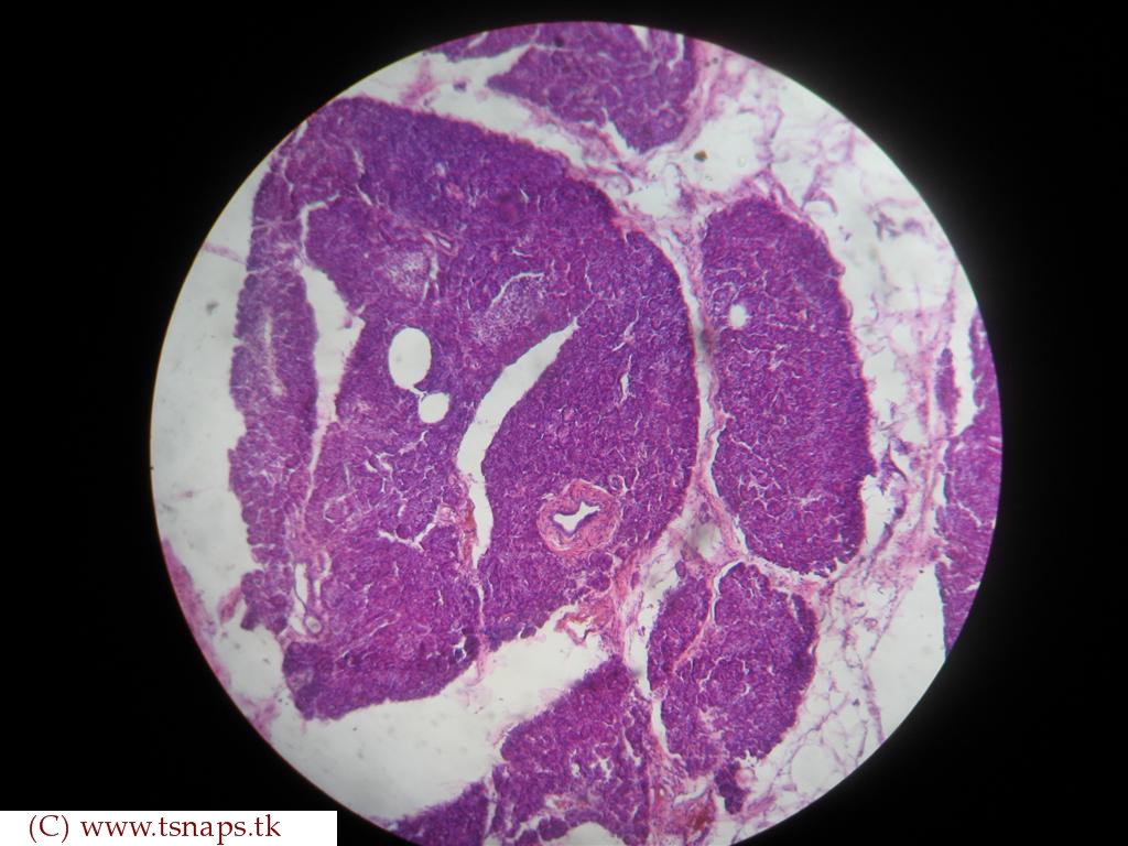 Human Pancreas Slide Labeled