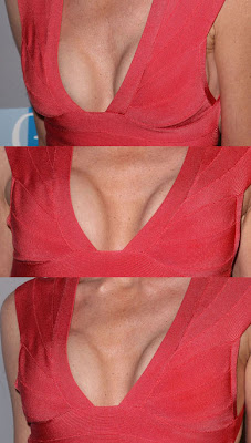 Sharon Stone Breast Implants